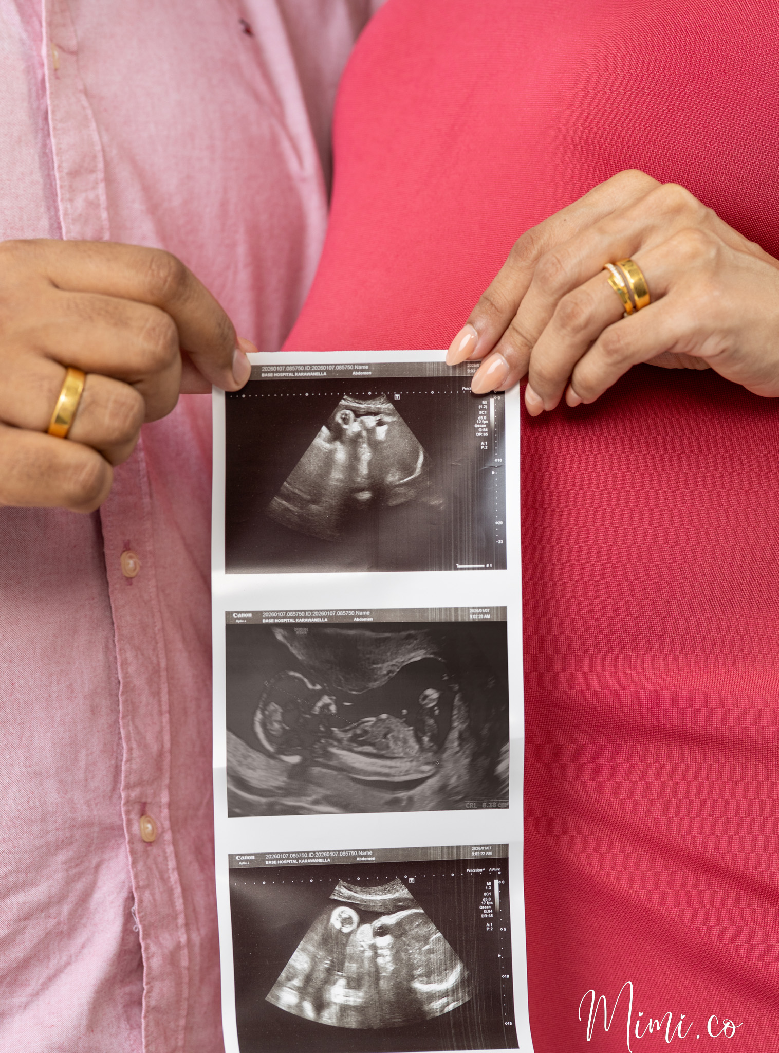 Maternity session — Studio Mimico